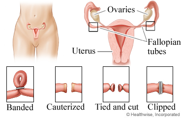 ../images/23388ea43e8f3bd0192480d79228fa16.jpg