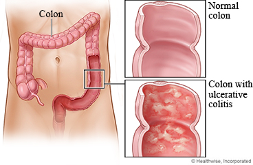 ../images/8eb1087f78f182f8925c31f10c98f1a9.jpg