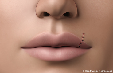 ../images/625da93367d8c888ee4d0ee144e57d14.jpg